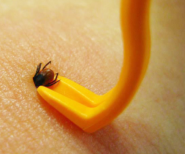 Tick Removing Tweezers