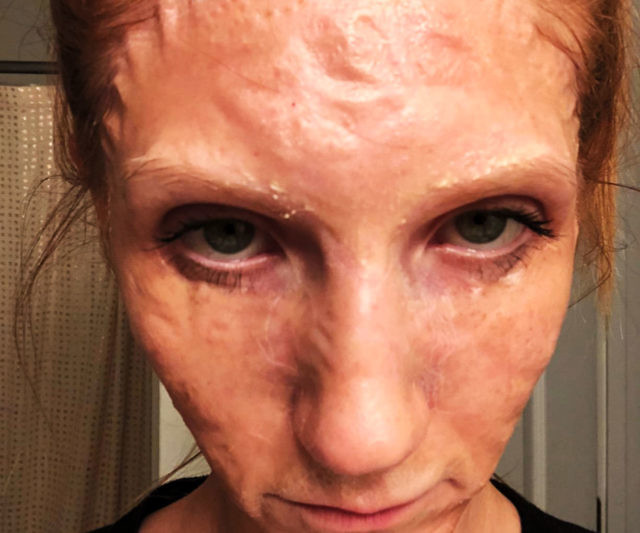 Zombie Face Treatment Masks